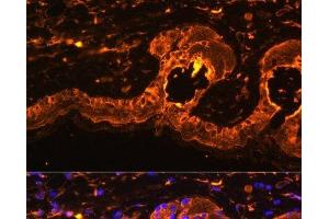 Immunofluorescence analysis of Mouse skin using TYR Polyclonal Antibody at dilution of 1:100. (TYR Antikörper)
