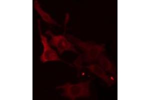 ABIN6266943 staining Hela cells by IF/ICC. (ELOVL1 Antikörper  (Internal Region))