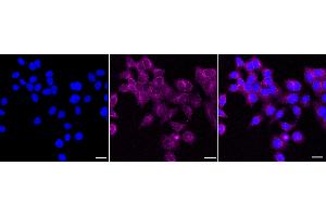 anti-Myosin VIIA (MYO7A) antibody