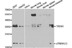 Western blot analysis of extracts of various cell lines, using TREM1 antibody. (TREM1 Antikörper  (AA 21-130))