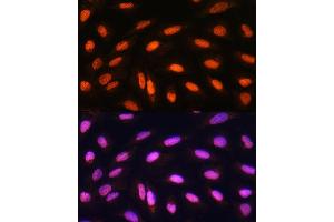 Immunofluorescence analysis of U2OS cells using KB Rabbit pAb (ABIN1680550, ABIN3015032, ABIN3015033, ABIN5663568 and ABIN6213605) at dilution of 1:100. (KAT2B Antikörper  (AA 583-832))
