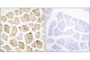 Immunohistochemistry analysis of paraffin-embedded human skeletal muscle tissue, using MAPK3 Antibody.
