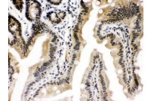 Immunohistochemistry (IHC) image for anti-CCCTC-Binding Factor (Zinc Finger Protein) (CTCF) (AA 521-727) antibody (ABIN3043817)