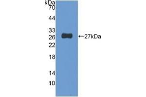 Detection of Recombinant NUP155, Human using Polyclonal Antibody to Nucleoporin 155 (NUP155) (NUP155 Antikörper  (AA 1154-1379))