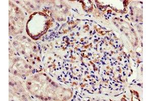 anti-ATP5F1A (AA 59-257) antibody