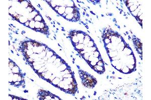 Immunohistochemistry of paraffin-embedded human colon using PDK2 Rabbit mAb (ABIN7269773) at dilution of 1:100 (40x lens). (PDK2 Antikörper)
