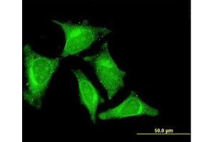 Image no. 3 for anti-RasGEF Domain Family, Member 1C (RASGEF1C) (AA 168-261) antibody (ABIN599341) (RASGEF1C Antikörper  (AA 168-261))
