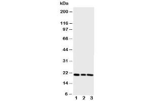 Western blot testing of PBP antibody and Lane 1:  rat brain (PEBP1 Antikörper  (N-Term))