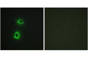 Immunofluorescence analysis of HeLa cells, using T3JAM Antibody. (TRAF3IP3 Antikörper  (AA 251-300))