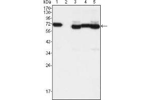 Western blot analysis using TCF3 mouse mAb against A549 (1), A431 (2), Hela (3), PANC-1 (4) and PC-3 (5) cell lysate. (TCF3 Antikörper)