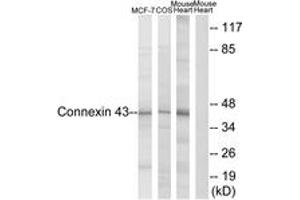 Western blot analysis of extracts from MCF-7/COS7/Mouse Heart, using Connexin 43 (Ab-367) Antibody.