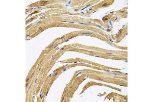 Immunohistochemistry of paraffin-embedded rat heart using CEP164 antibody. (CEP164 Antikörper)