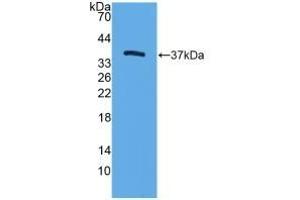 Detection of Recombinant TFF3, Mouse using Polyclonal Antibody to Trefoil Factor 3 (TFF3) (TFF3 Antikörper  (AA 23-81))