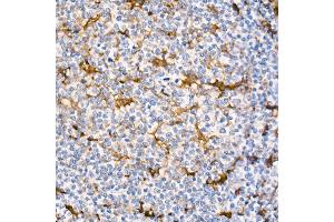 Immunohistochemistry of paraffin-embedded Human tonsil (positive control antibody staining, clone 55k-2) using Fascin/FSCN1 antibody (ABIN7267142) at dilution of 1:100 (40x lens). (Fascin Antikörper)