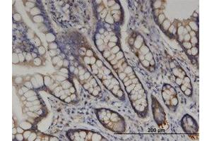 Image no. 2 for anti-Arginyl-tRNA Synthetase (RARS) (AA 1-661) antibody (ABIN599427) (RARS Antikörper  (AA 1-661))