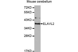 Western Blotting (WB) image for anti-ELAV (Embryonic Lethal, Abnormal Vision, Drosophila)-Like 2 (Hu Antigen B) (ELAVL2) antibody (ABIN1876947)
