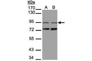 WB Image Sample(30 μg of whole cell lysate) A:293T B:Raji, 7. (NIR1 Antikörper  (C-Term))