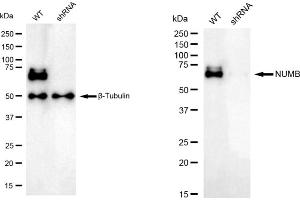 Western blotting analysis using NUMB antibody (ABIN7799692). (Rekombinanter NUMB Antikörper)
