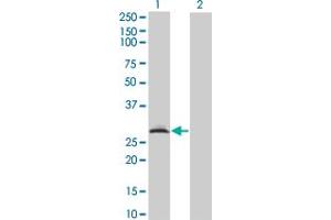 Western Blot analysis of RAD1 expression in transfected 293T cell line by RAD1 monoclonal antibody (M01A), clone 1G2. (RAD1 Antikörper  (AA 1-90))