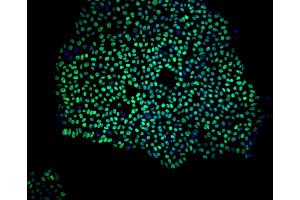 Immunoflourescent staining of Nanog in human embryonic stem cells. (Nanog Antikörper)