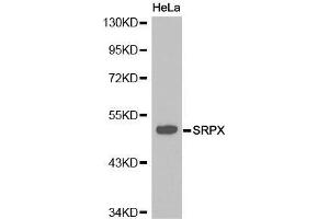 Western Blotting (WB) image for anti-Sushi-Repeat Containing Protein, X-Linked (SRPX) (AA 40-320) antibody (ABIN6215763) (SRPX Antikörper  (AA 40-320))