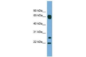 MMP26 antibody used at 0. (MMP26 Antikörper  (C-Term))