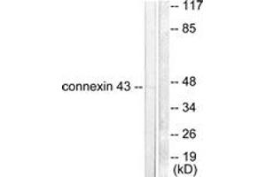 Western blot analysis of extracts from A549 cells, using Connexin 43 Antibody. (Connexin 43/GJA1 Antikörper  (AA 333-382))