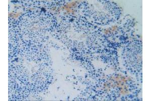 IHC-P analysis of Mouse Testis Tissue, with DAB staining. (MAPT Antikörper  (AA 92-400))