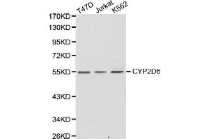 Western Blotting (WB) image for anti-Cytochrome P450, Family 2, Subfamily D, Polypeptide 6 (CYP2D6) (AA 20-230) antibody (ABIN6216807) (CYP2D6 Antikörper  (AA 20-230))