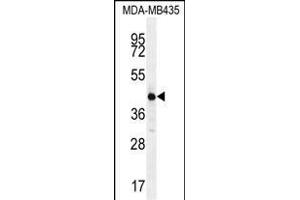 ALX4 Antibody (Center) (ABIN654344 and ABIN2844113) western blot analysis in MDA-M cell line lysates (35 μg/lane). (ALX4 Antikörper  (AA 249-275))