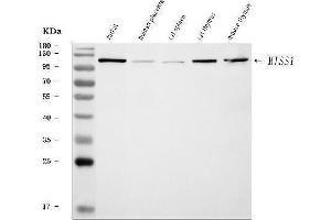 Western blot analysis of MIM/MTSS1 using anti-MIM/MTSS1 antibody (ABIN7600276).