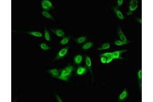 Immunofluorescent analysis of Hela cells using ABIN7168329 at dilution of 1:100 and Alexa Fluor 488-congugated AffiniPure Goat Anti-Rabbit IgG(H+L) (RNA Binding Motif Protein, Y Chromosome (RBMY) (AA 501-700) Antikörper)