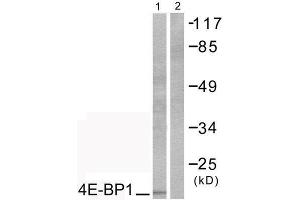 Western Blotting (WB) image for anti-Eukaryotic Translation Initiation Factor 4E Binding Protein 1 (EIF4EBP1) (Thr70) antibody (ABIN1847930) (eIF4EBP1 Antikörper  (Thr70))
