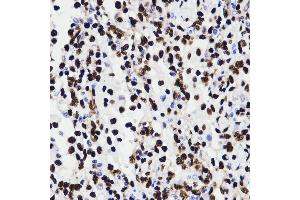 Immunohistochemistry (IHC) image for anti-High Mobility Group Box 1 (HMGB1) (AA 100-200) antibody (ABIN3023358) (HMGB1 Antikörper  (AA 100-200))