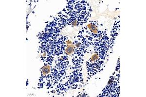 Immunohistochemistry of paraffin embedded mouse bone using TREML1 (ABIN7076009) at dilution of 1:2200 (400x lens)