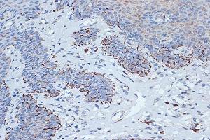 Immunohistochemistry of paraffin-embedded human esophageal using STK3/MST2 Rabbit mAb (ABIN7270223) at dilution of 1:100 (40x lens). (STK3 Antikörper)