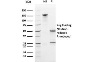 SDS-PAGE Analysis Purified CD5 Mouse Monoclonal Antibody (CD5/2419). (CD5 Antikörper  (AA 269-366))