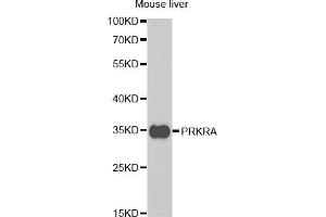 Western blot analysis of extracts of mouse liver, using PRKRA antibody (ABIN5973144) at 1/1000 dilution. (PRKRA Antikörper)
