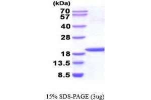 SDS-PAGE (SDS) image for Non-Metastatic Cells 1, Protein (NM23A) Expressed in (NME1) (AA 1-152) (Active) protein (ABIN6387708)