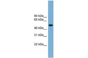 WB Suggested Anti-UBQLNL Antibody Titration: 0. (UBQLNL Antikörper  (Middle Region))