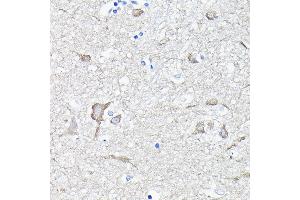 Immunohistochemistry of paraffin-embedded human brain using EEF1 Rabbit pAb (ABIN6129010, ABIN6139947, ABIN6139948 and ABIN6223167) at dilution of 1:100 (40x lens). (EEF1A2 Antikörper  (AA 184-463))