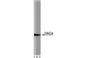 Western Blotting (WB) image for anti-RAB11A, Member RAS Oncogene Family (RAB11A) (AA 86-207) antibody (ABIN968091) (RAB11A Antikörper  (AA 86-207))