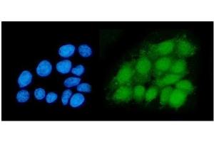 IF analysis of DHPS/DHS using anti-DHPS/DHS antibody (ABIN7601998). (DHPS Antikörper  (AA 54-358))