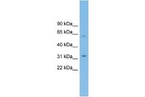 WB Suggested Anti-SLC39A9 Antibody Titration: 0.
