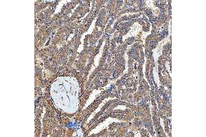 IHC analysis of SFXN3 using anti-SFXN3 antibody (ABIN7601302). (SFXN3 Antikörper  (AA 32-321))