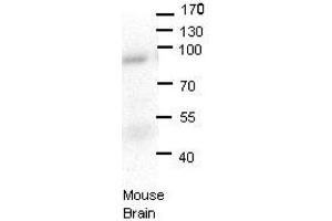 LSS antibody - N-terminal region  validated by WB using Mouse brains at 1:1000. (LSS Antikörper  (N-Term))