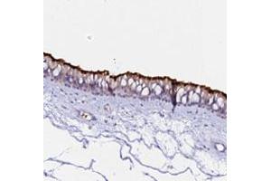 Immunohistochemical staining of human nasopharynx with CCDC19 polyclonal antibody  shows strong positivity in cilia of respiratory epithelial cells at 1:200-1:500 dilution. (CCDC19 Antikörper)