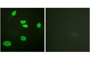 Immunofluorescence analysis of HeLa cells, using Histone H3 (Acetyl-Lys9) Antibody. (Histone 3 Antikörper  (H3K9ac))