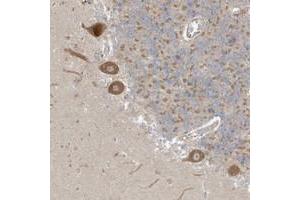 Immunohistochemical staining of human cerebellum with NPPC polyclonal antibody  shows moderate cytoplasmic positivity in purkinje cells. (NPPC Antikörper)