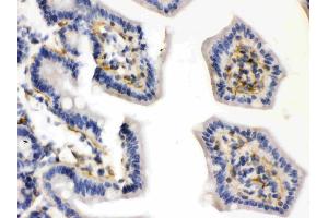 Caldesmon was detected in paraffin-embedded sections of mouse intestine tissues using rabbit anti- Caldesmon Antigen Affinity purified polyclonal antibody (Catalog # ) at 1 µg/mL. (Caldesmon Antikörper  (AA 1-120))